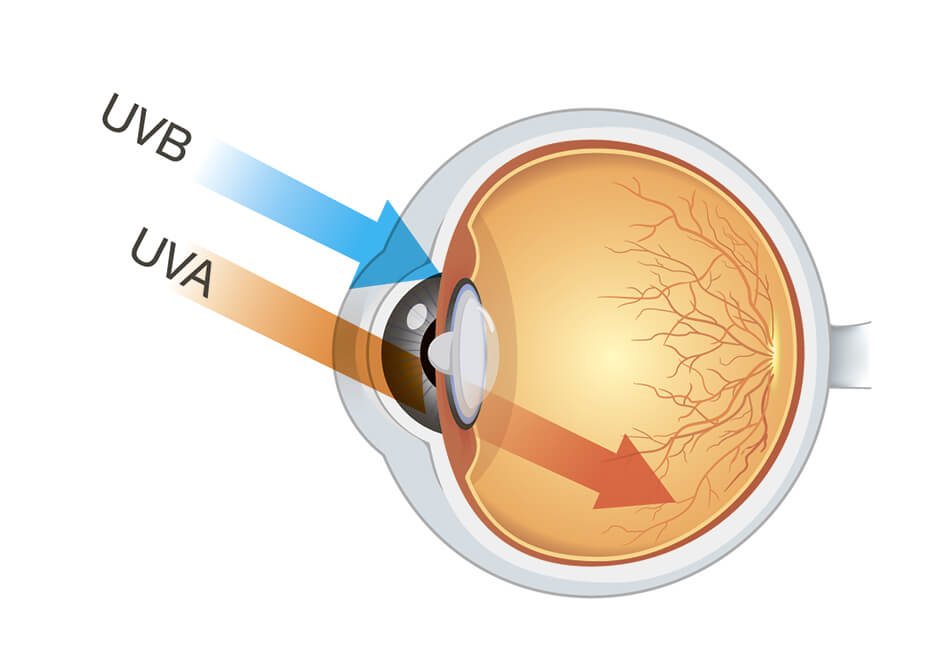 Lentes de contacto com proteção UV